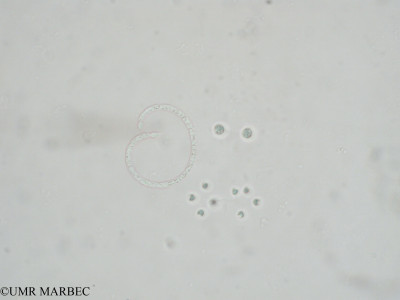 phyto/Mayotte/combani/Retenues_collinaires_de_Mayotte  2006-2009/Dictyosphaerium sp2 et Dictyosphaerium sp3 (x1.5x40 70709)(copy)_thumb.jpg